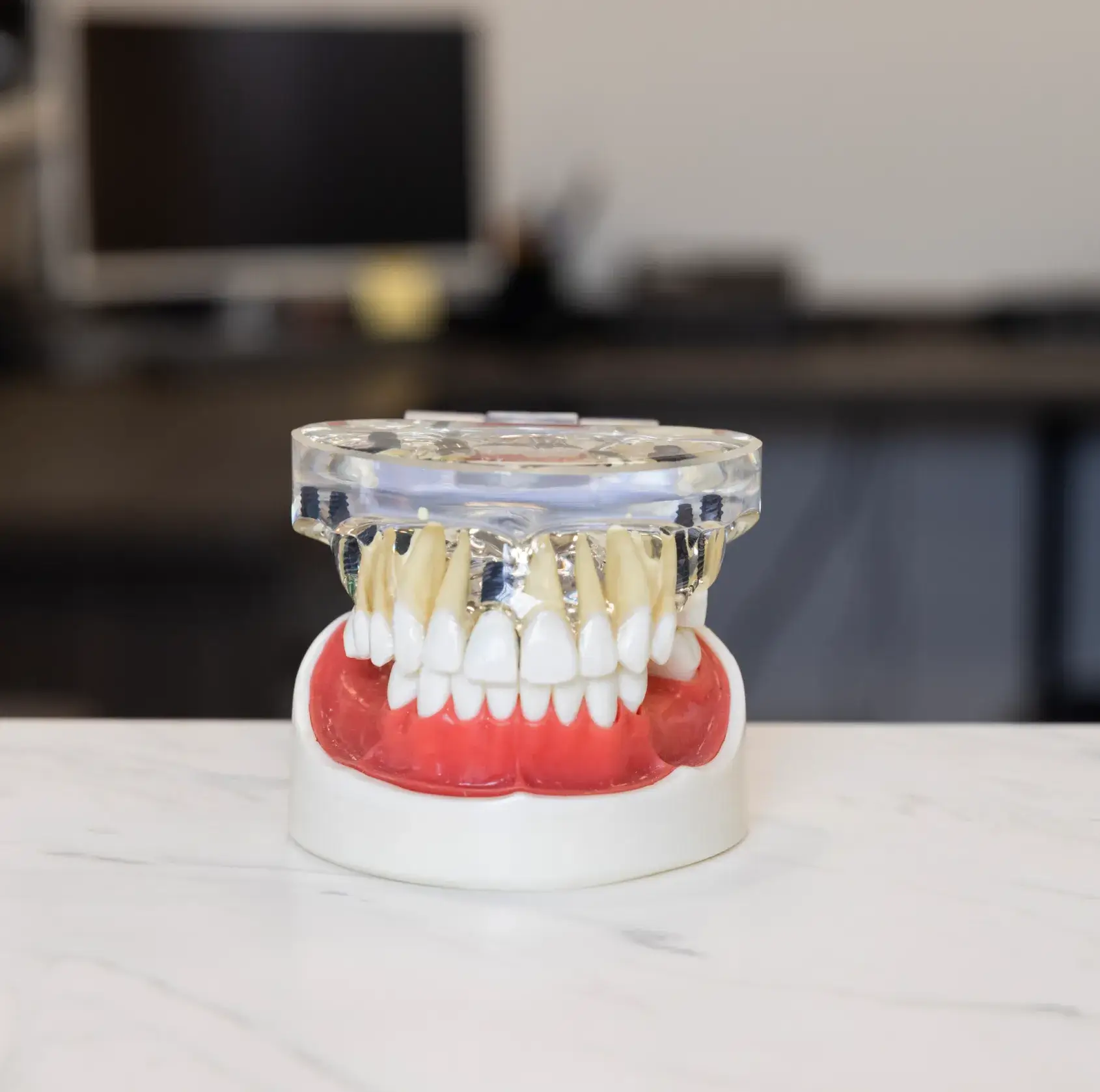 A dental model showing upper and lower teeth placed on a white surface.