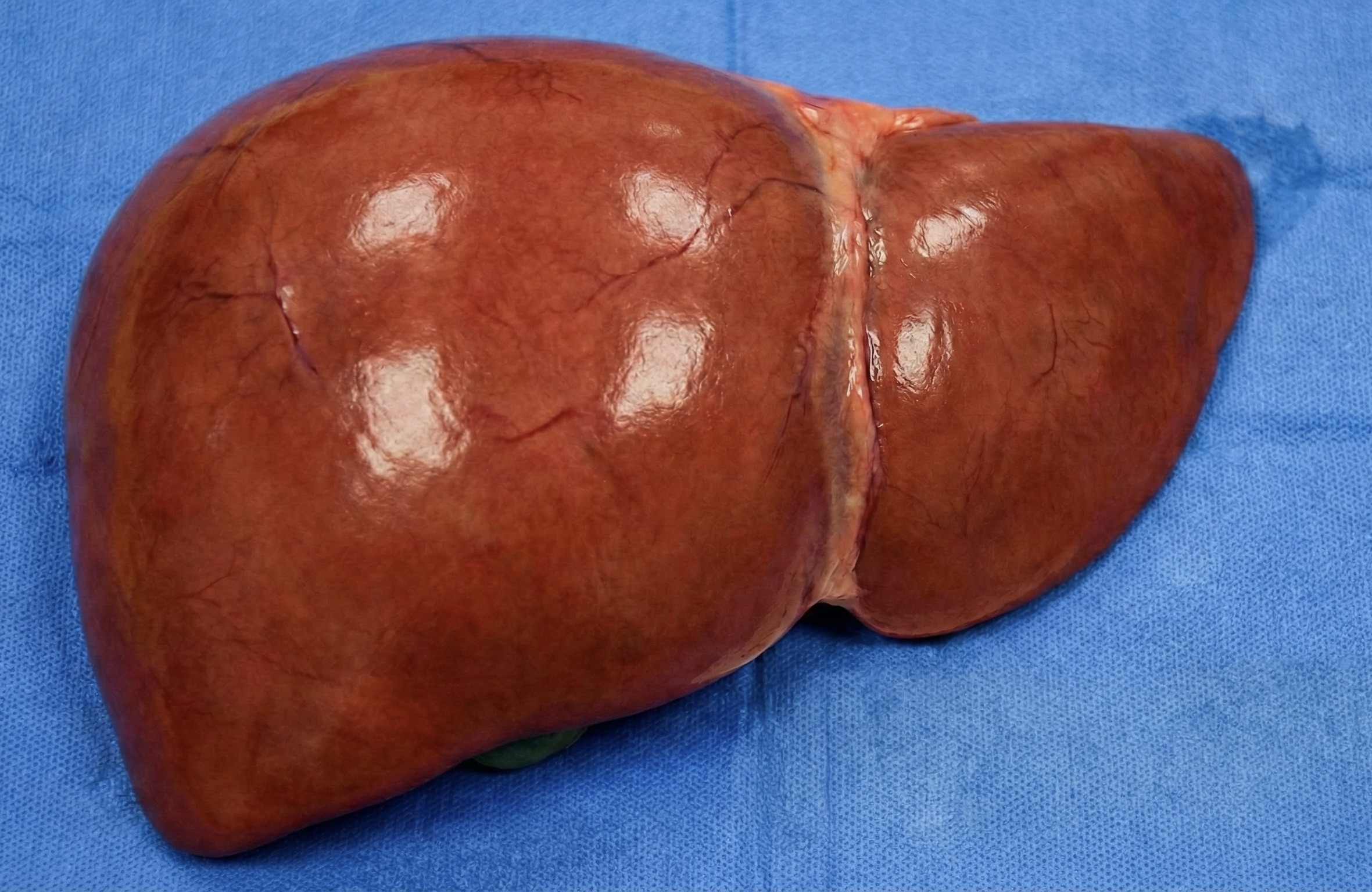 man with low testosterone 