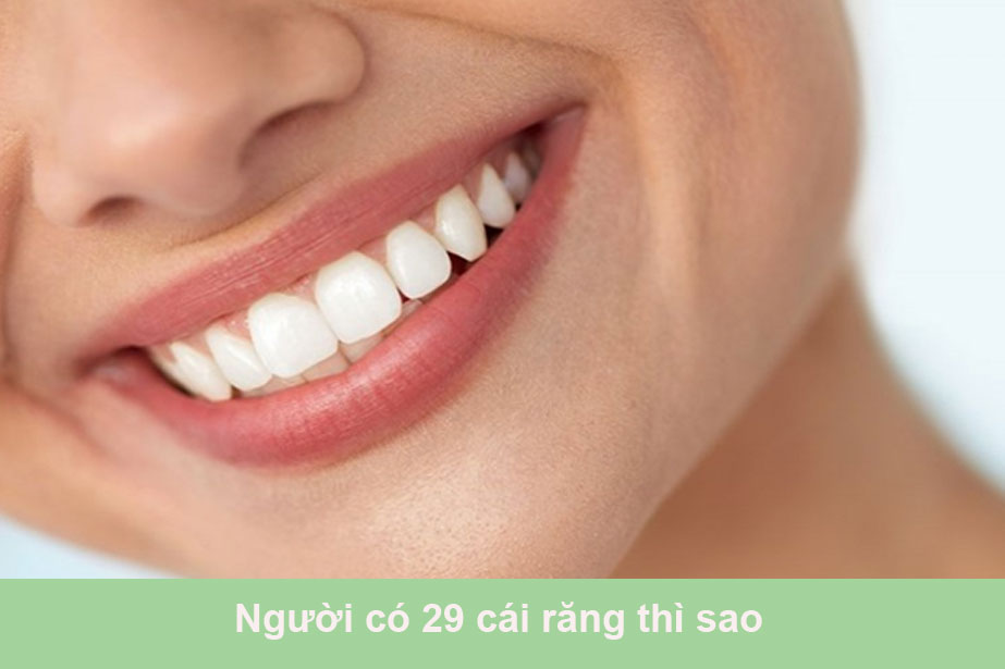29 cái răng