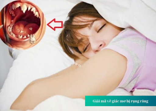 Răng cấm bị gãy