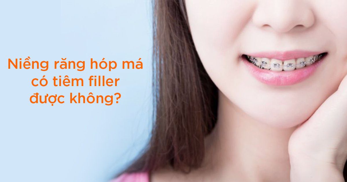 Tiêm filler khi đang đeo niềng có sao không?