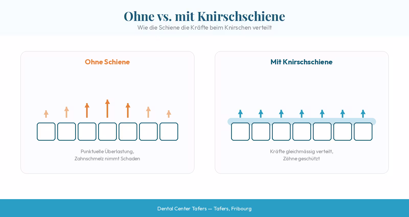 Knirschschiene Vergleich: Ohne Schiene vs. mit Schiene – Kraftverteilung auf Zähne, Dental Center Tafers