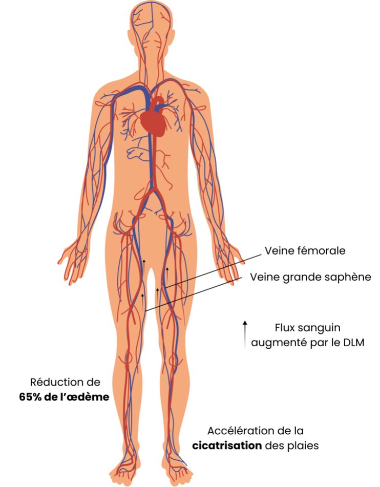 Insuffisance veineuse : comment le drainage lymphatique manuel peut-il aider ?