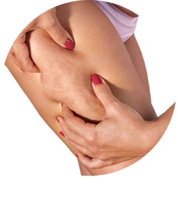 Le drainage lymphatique, un allié anti-cellulite ?