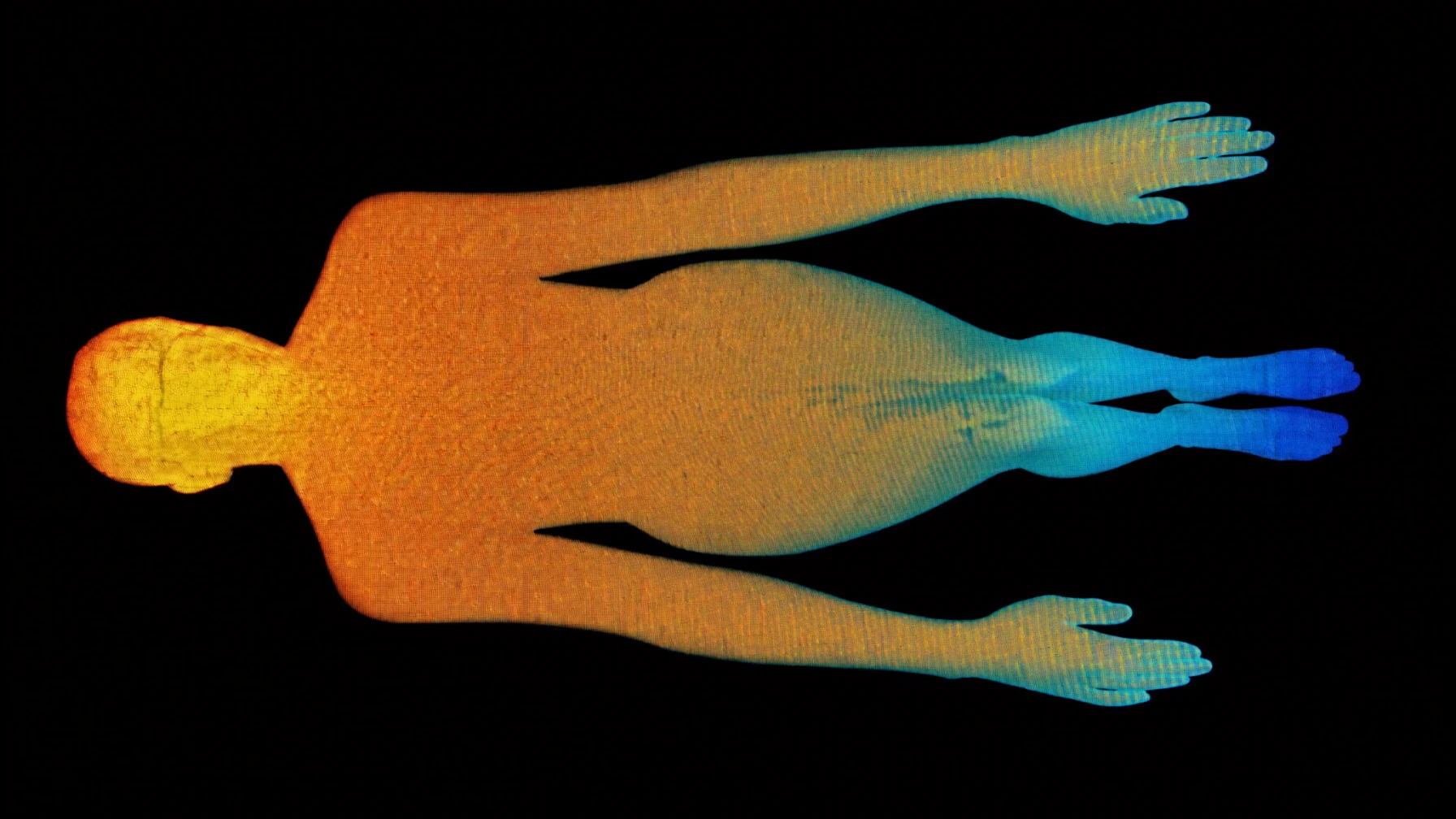 Thermographic view of skin temperature: warm trunk, cooler extremities