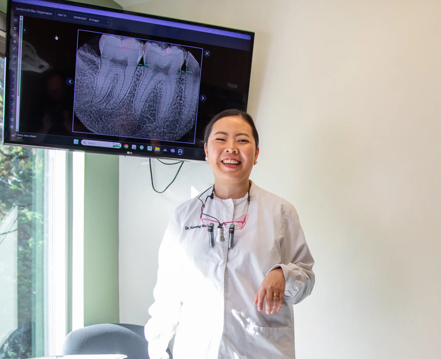 Root Canals at Creative Smiles, Vancouver, WA