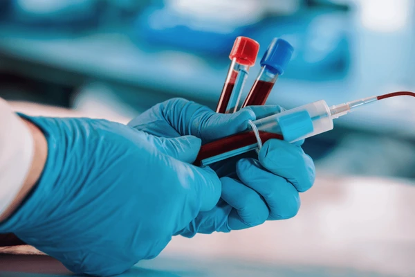 "Blood Work for Blokes: Why ‘Normal’ Isn’t Always Good Enough if You Want to Actually Feel Better"