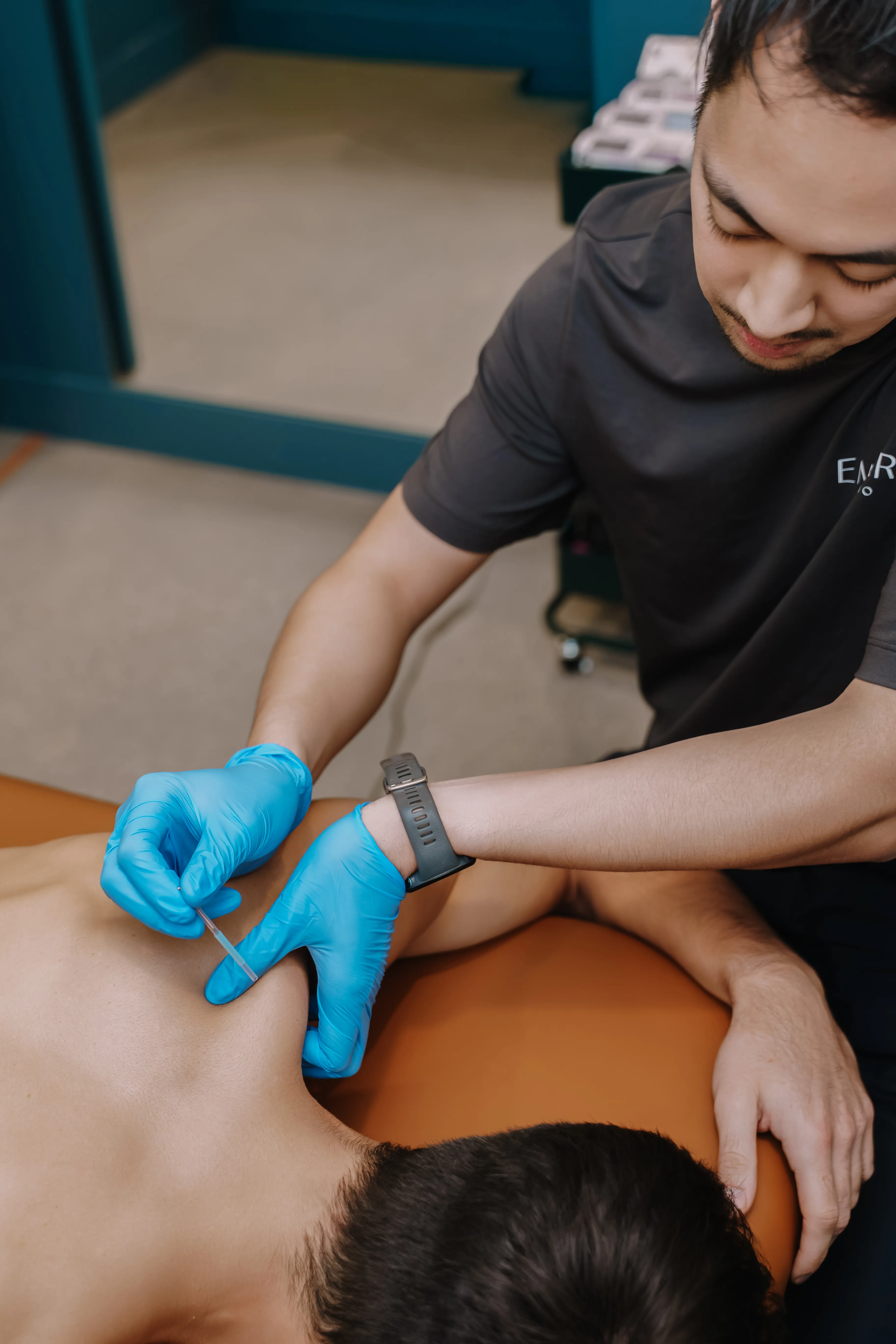 Physiotherapist preforming a dry needling technique to release muscle tension