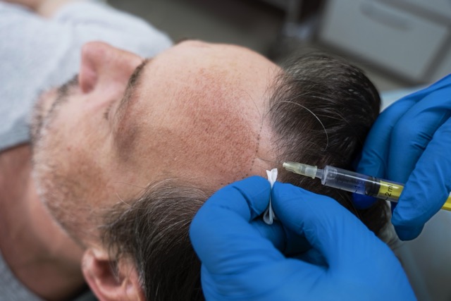 Hair Treatment Apa yang Paling Ampuh Atasi Rambut Rontok dan Kering?