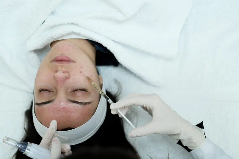 Exosome Therapy: Apakah Aman dan Seberapa Cepat Hasilnya Terlihat?