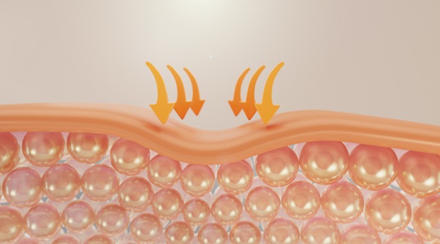 Perawatan untuk Memperbaiki Skin Barrier: Produk dan Treatment yang Efektif
