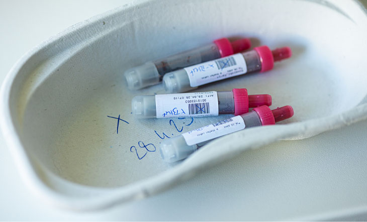 Ein Tablett mit fünf beschrifteten Blutprobenröhrchen mit roten Verschlüssen.