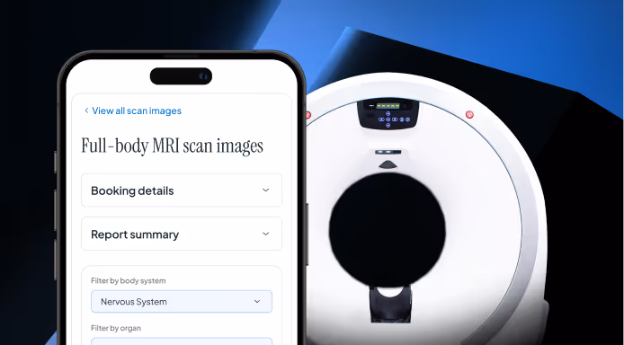 Smartphone displaying a full-body MRI scan images interface with filters, positioned in front of an MRI machine.