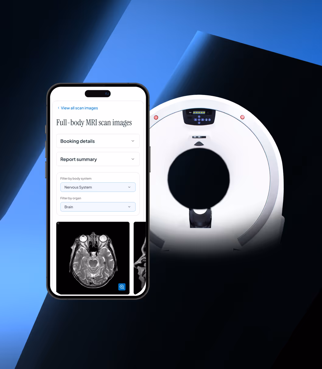 Mobile phone screen showing full-body MRI scan images with filters for nervous system and brain, next to an MRI scanner.