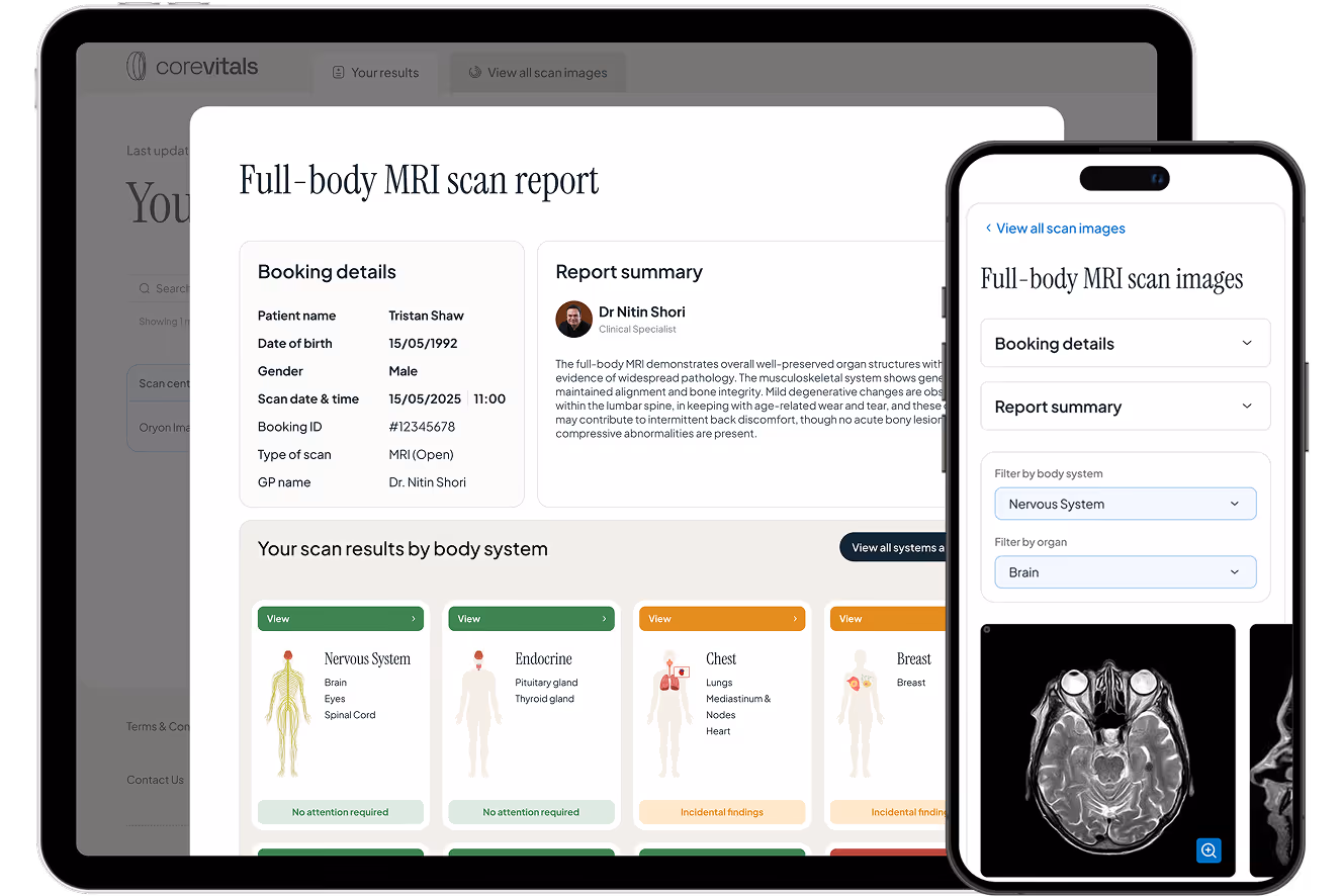 Tablet and smartphone showing a full-body MRI scan report and images with booking details, report summary, and scan results by body system.