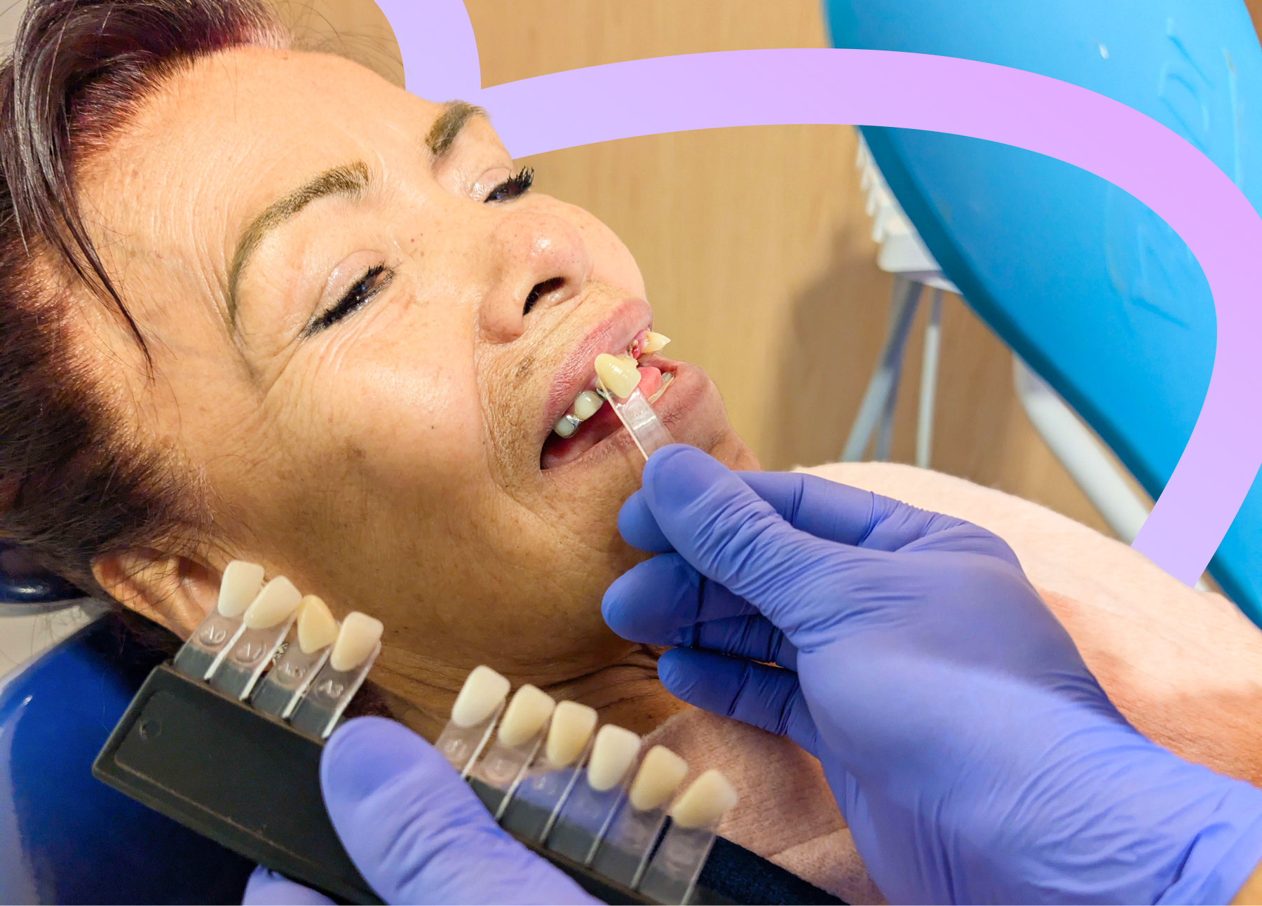 Dentista tomando impresiones para dentadura parcial personalizada