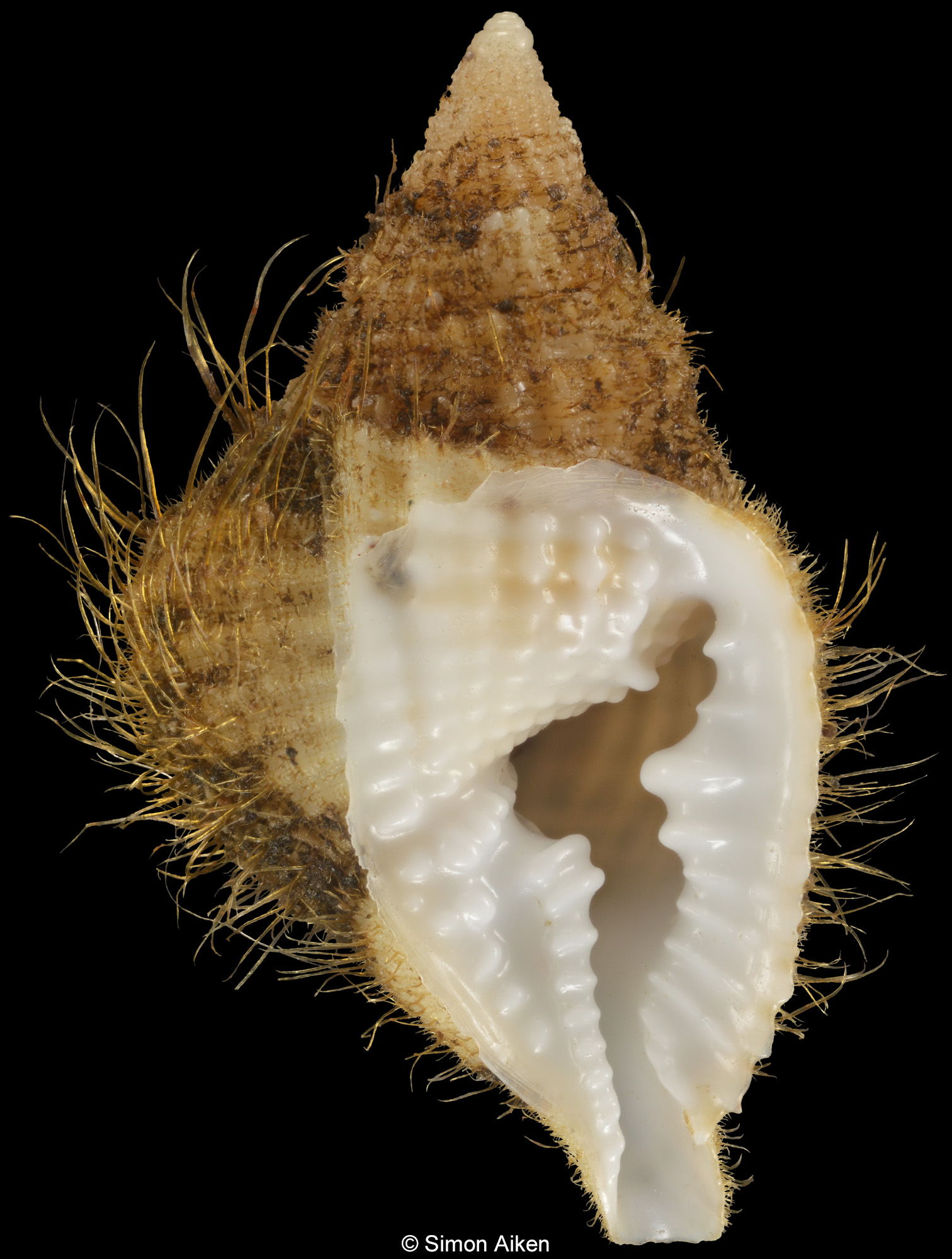 Distorsio euconstricta