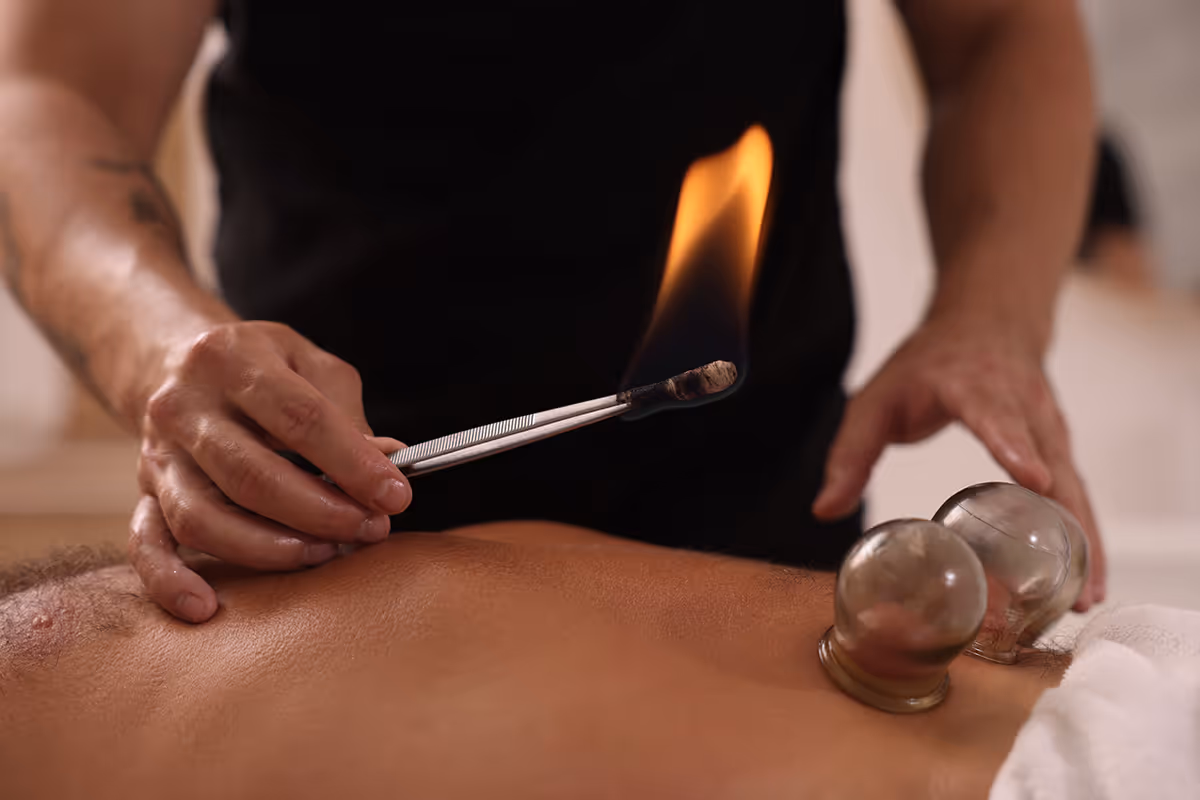 Fire cupping because...FIRE!