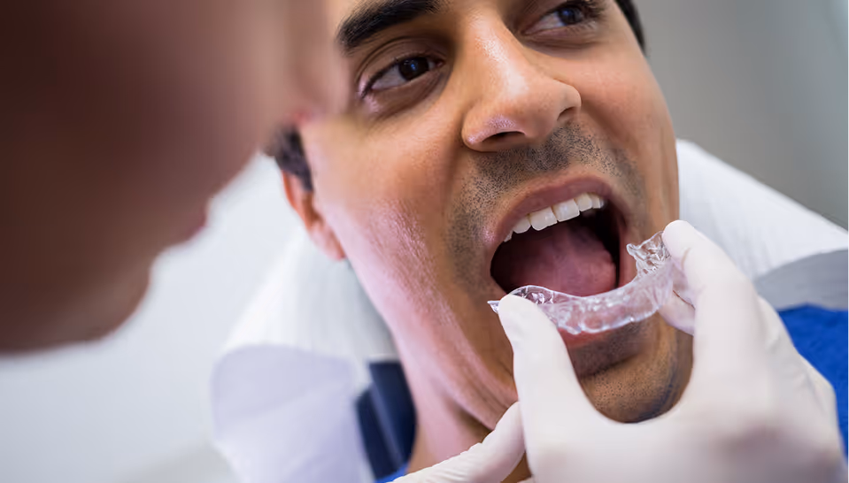 Dentist fitting clear dental aligner tray into open mouth of male patient in clinic.