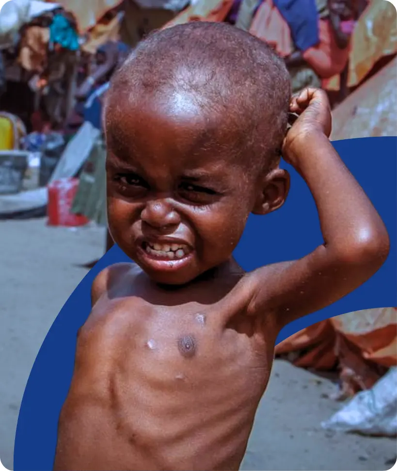 sudan child without food
