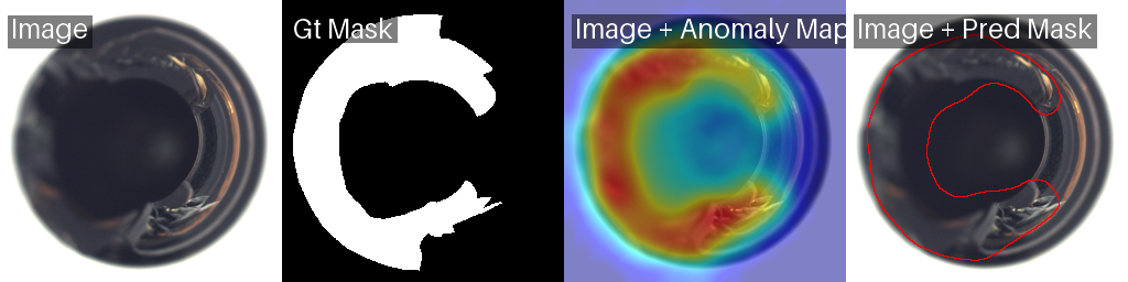 Defective bottle with ground truth mask, anomaly heatmap, and predicted mask highlighting detected defect region.