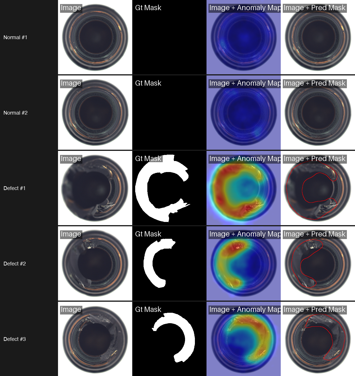 Grid of normal and defective bottles with ground truth masks, anomaly heatmaps, and predicted defect regions.