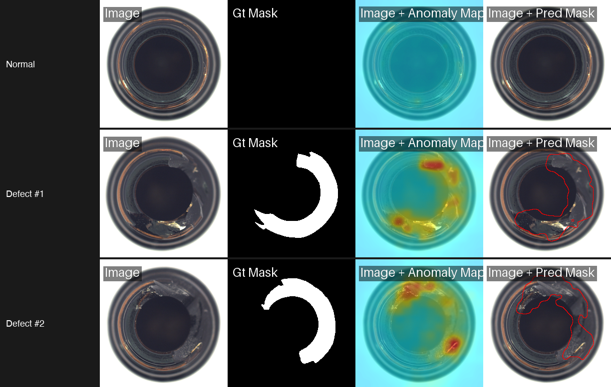 Normal and defective bottles with ground truth masks, anomaly heatmaps, and predicted defect segmentation results.