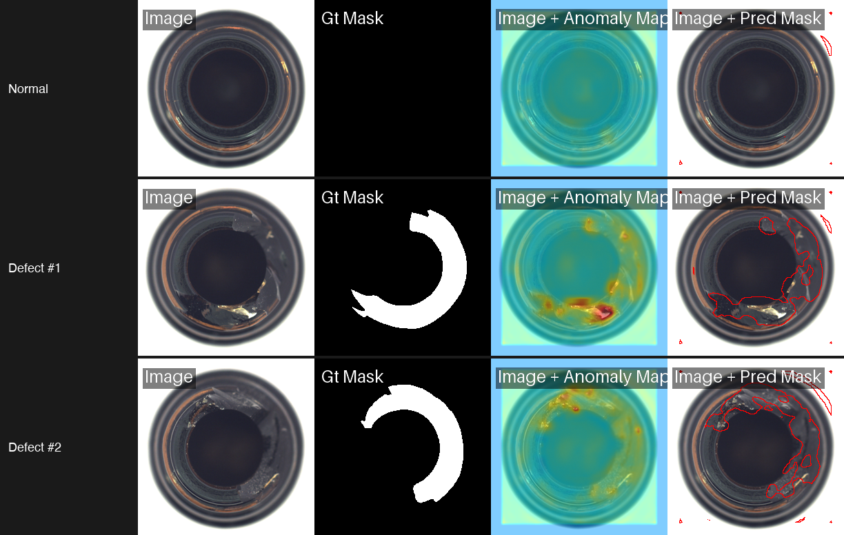 Bottle anomaly detection showing normal and defects with ground truth, heatmaps, and predicted segmentation masks.