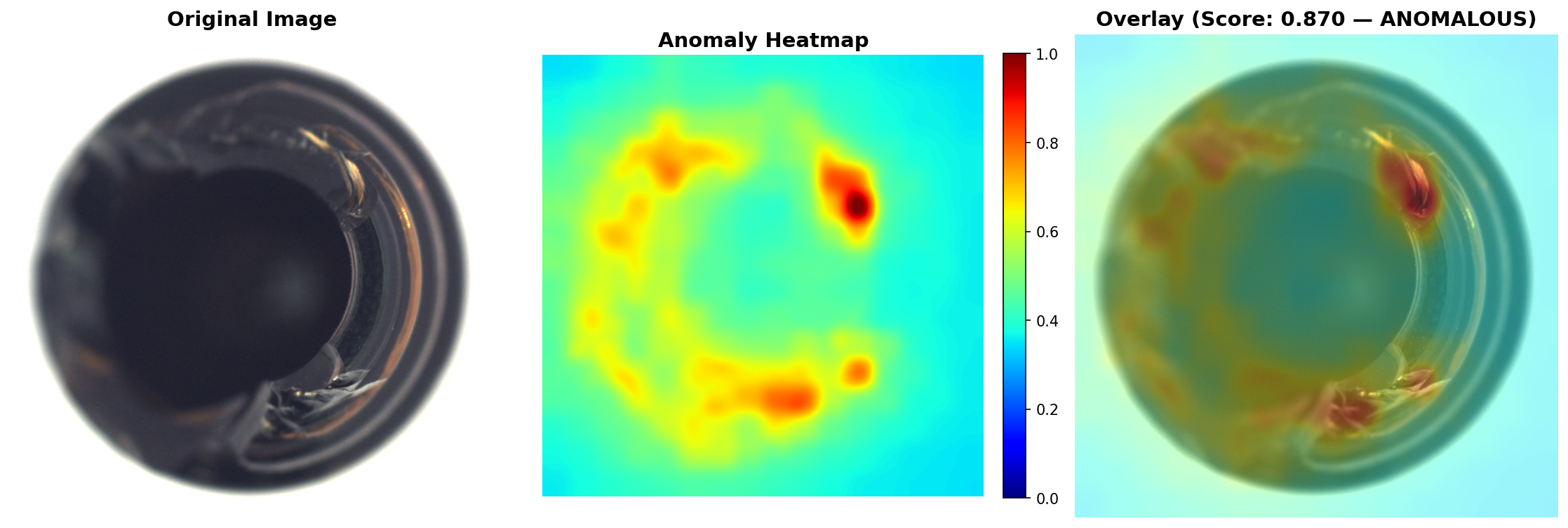 Bottle defect with anomaly heatmap and overlay showing score 0.870 labeled as anomalous.
