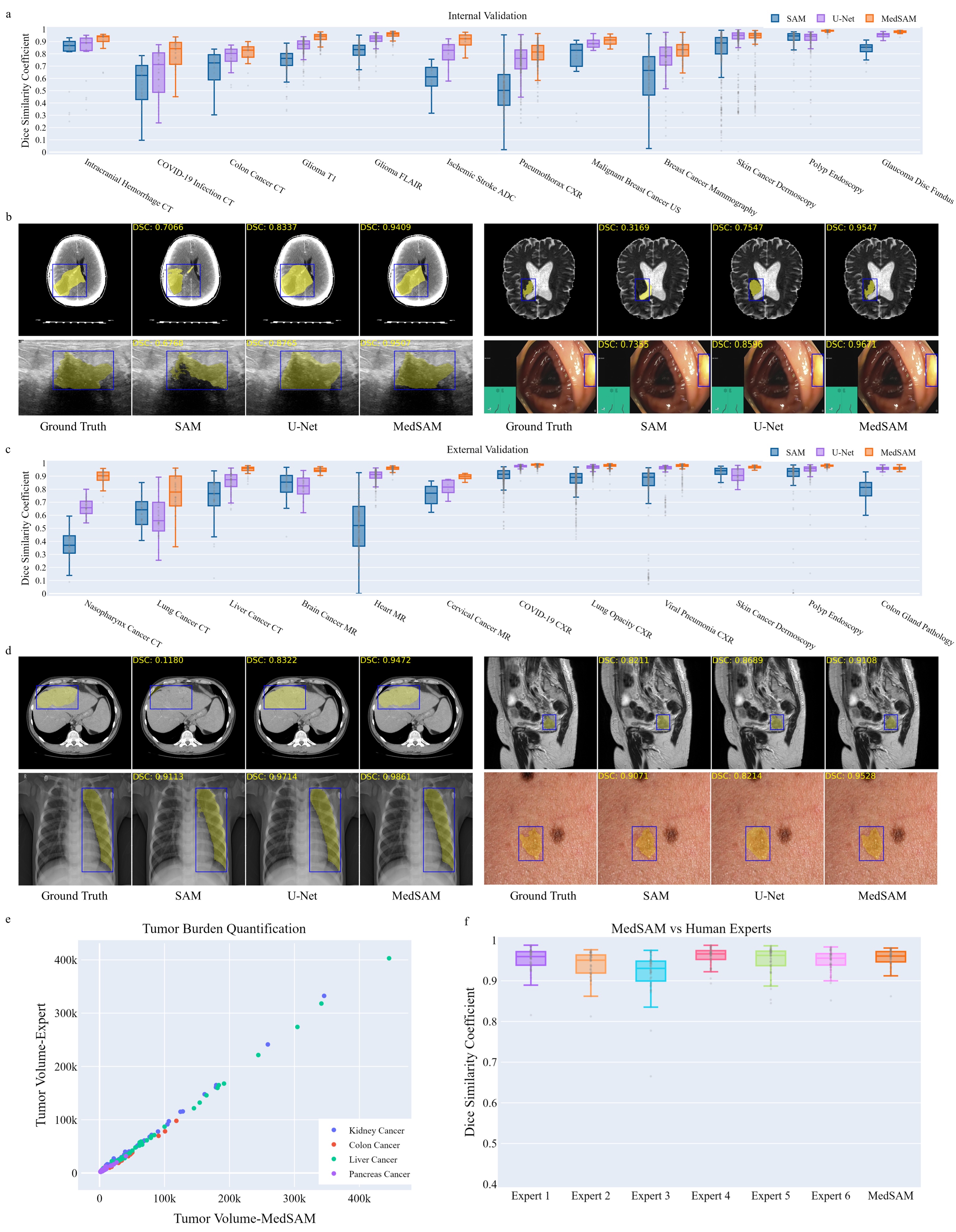 Comparison of segmentation results across models with DICE scores and ground truth reference
