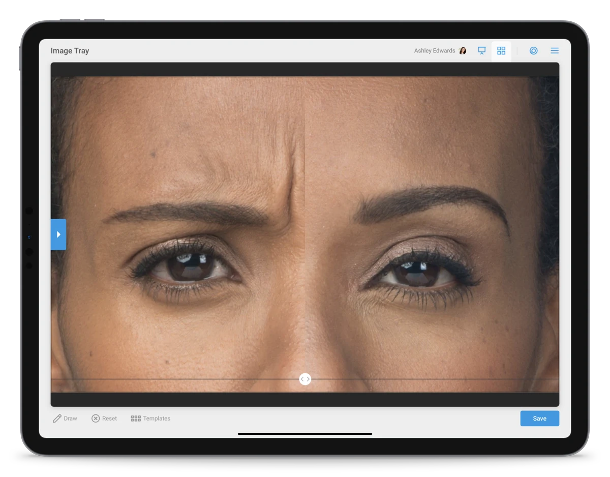 TouchMD: vendor composition showing photo comparison and annotation controls on a tablet.
