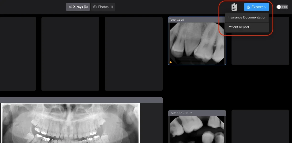 Pearl Second Opinion radiograph viewer with export options for insurance documentation and a patient report.