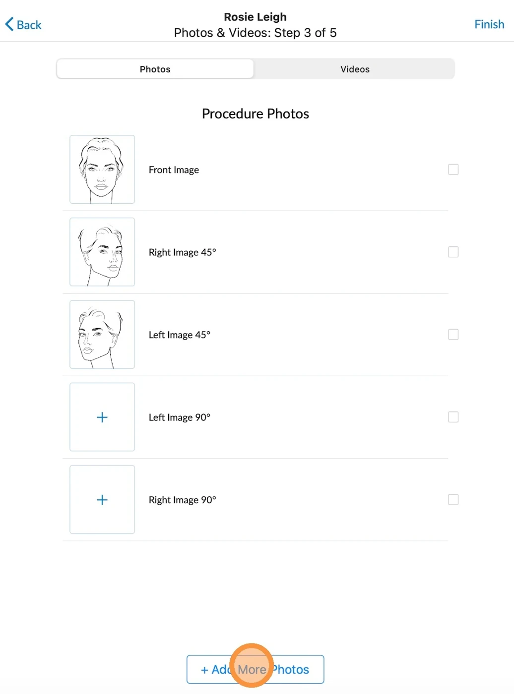 Aesthetic Record procedure-photo screen with five angle slots and an Add More Photos button