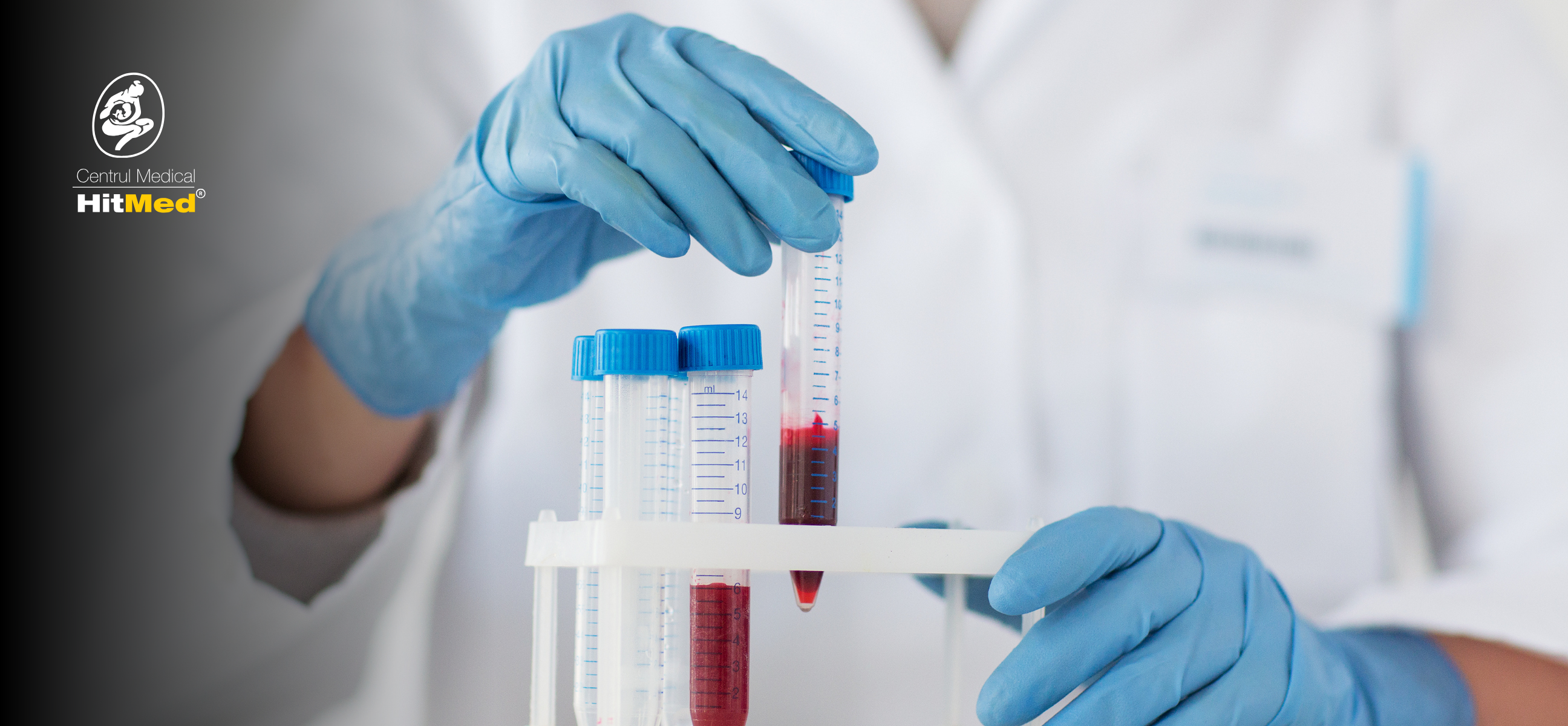 De ce să îți faci analizele medicale la început de an – Ghidul HITMED Craiova