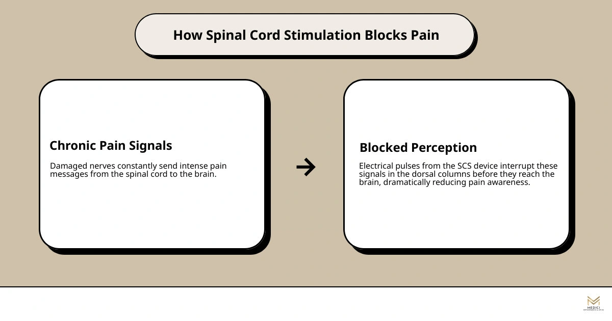 How a spinal cord stimulator blocks pain signals from spine to brain — step-by-step infographic infographic