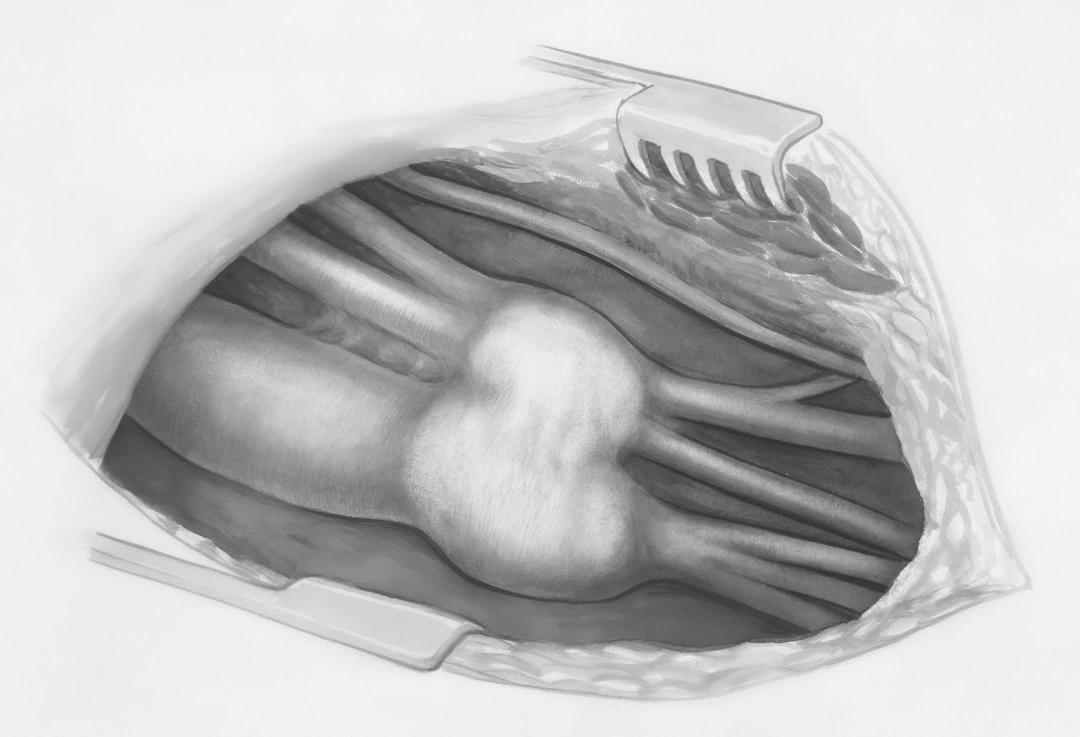 nerve pathways and compression points in the human arm