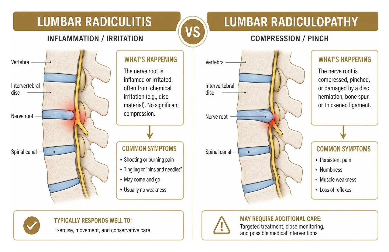 diagram comparing lumbar radiculitis inflammation versus radiculopathy compression diagram comparing lumbar radiculitis inflammation versus radiculopathy compression