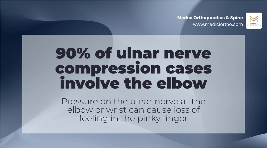 Ulnar nerve path from neck through elbow and wrist to pinky, showing common pressure points infographic Ulnar nerve path from neck through elbow and wrist to pinky, showing common pressure points infographic