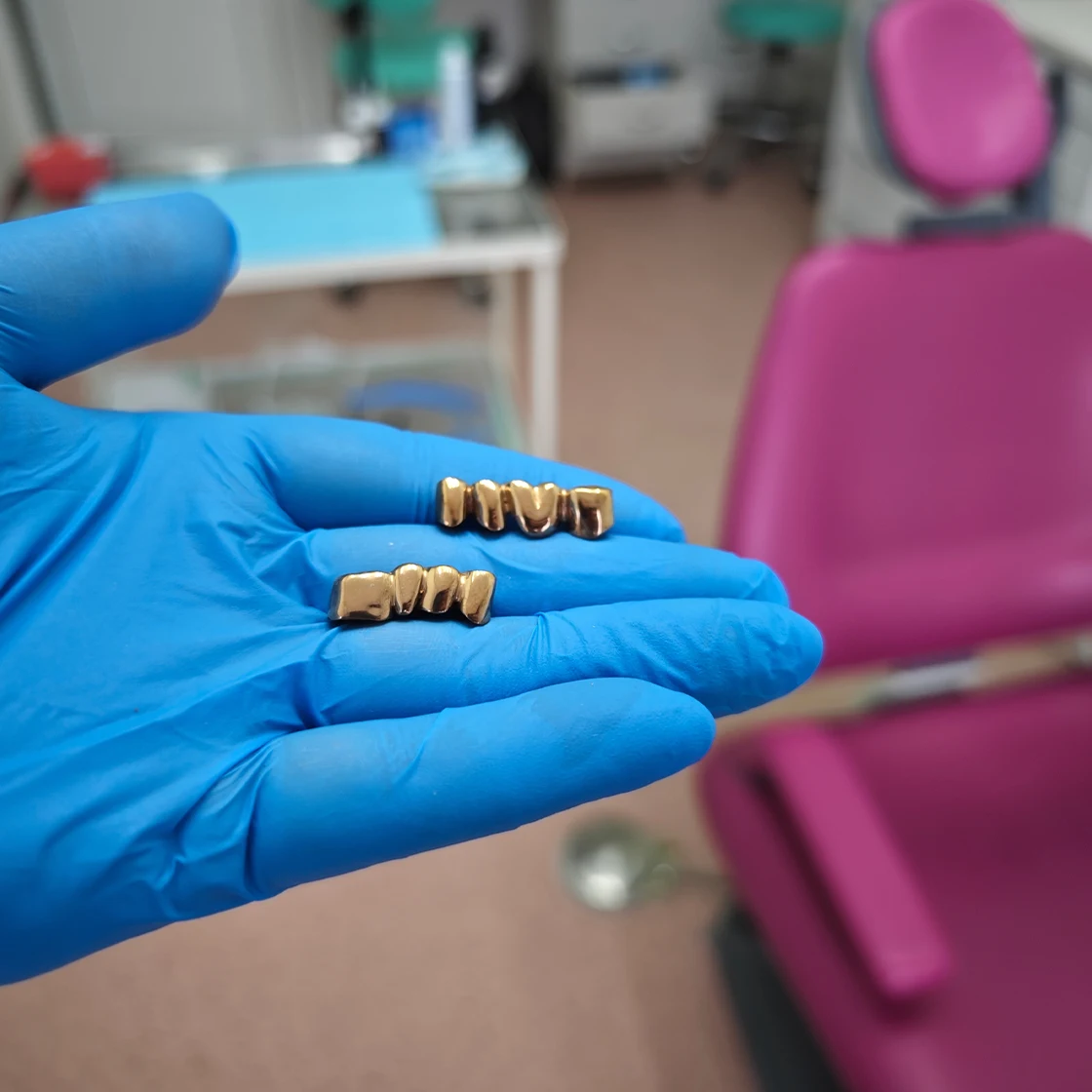 Dentist holds gold bridges