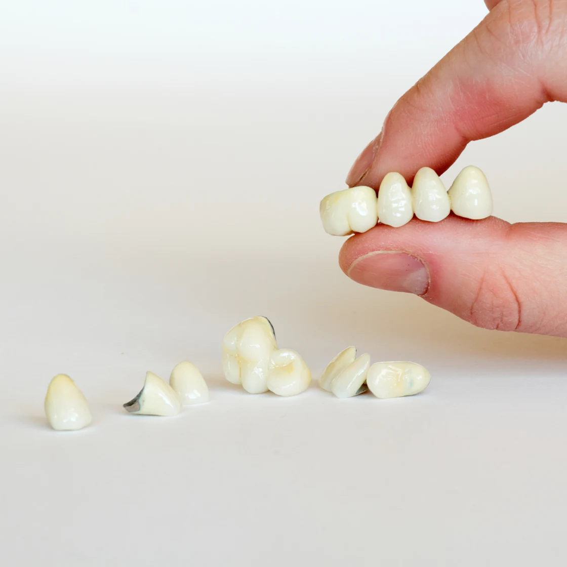 Durable and esthetic porcelain fused metal crowns and bridge