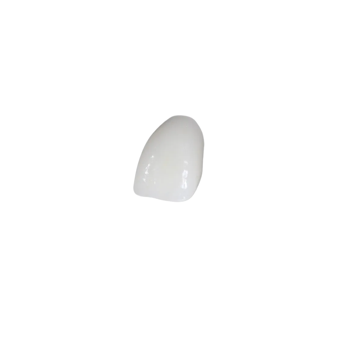 Single E-max crown showing its high translucency and natural tooth-like appearance.