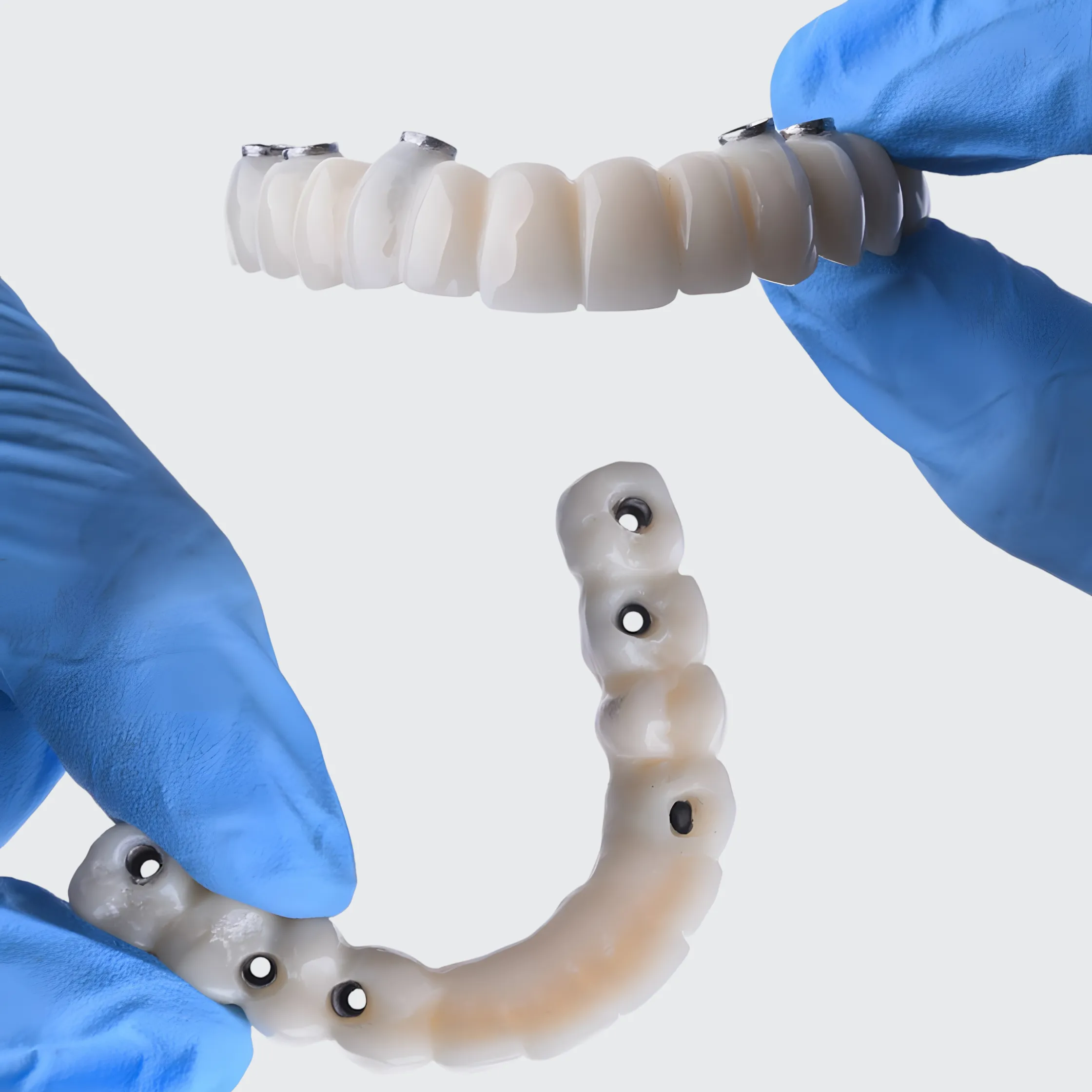 Technician holds 2 digitally crafted implant prosthesis