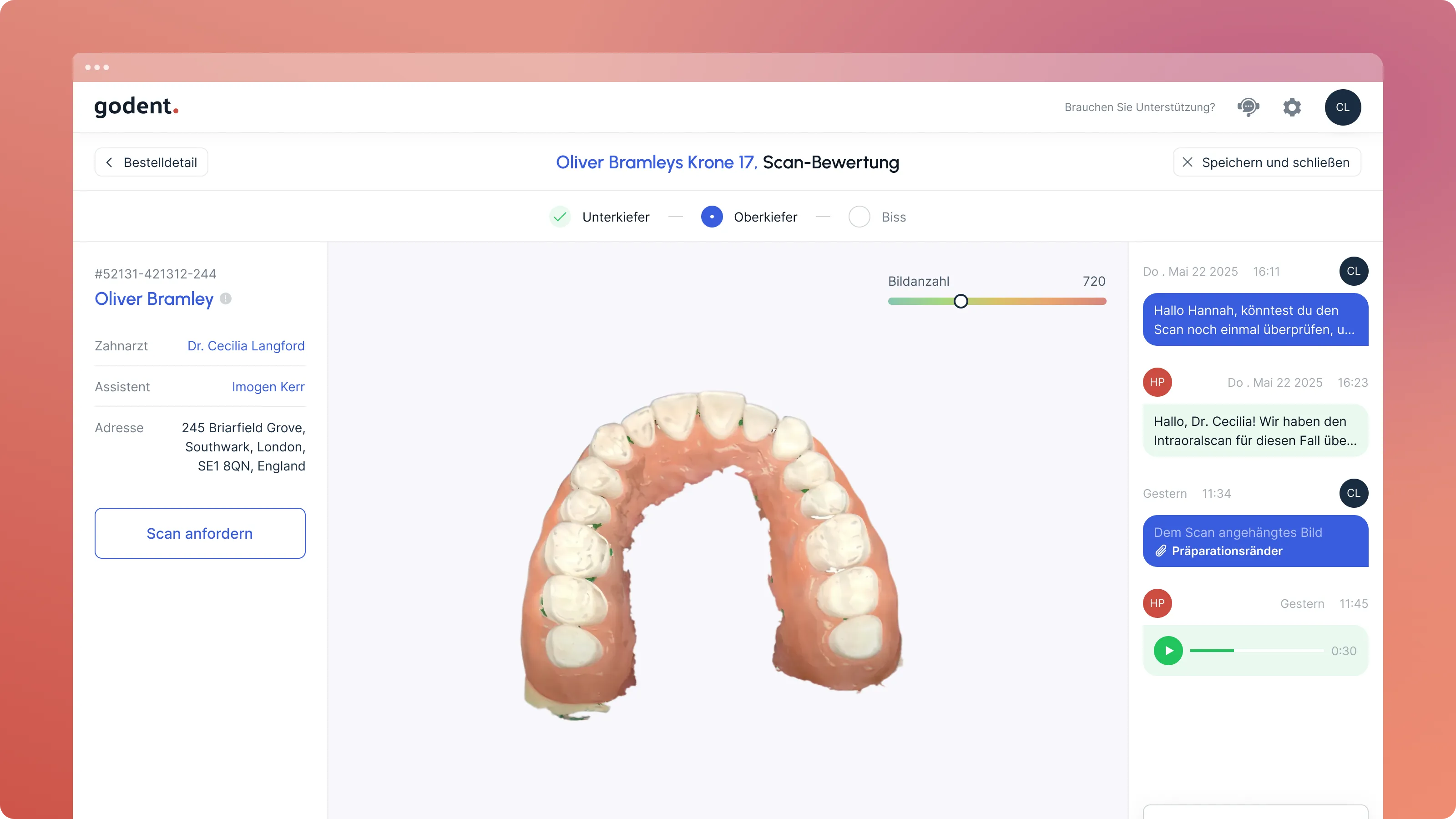 Live scan review of a dental impression on Godent portal
