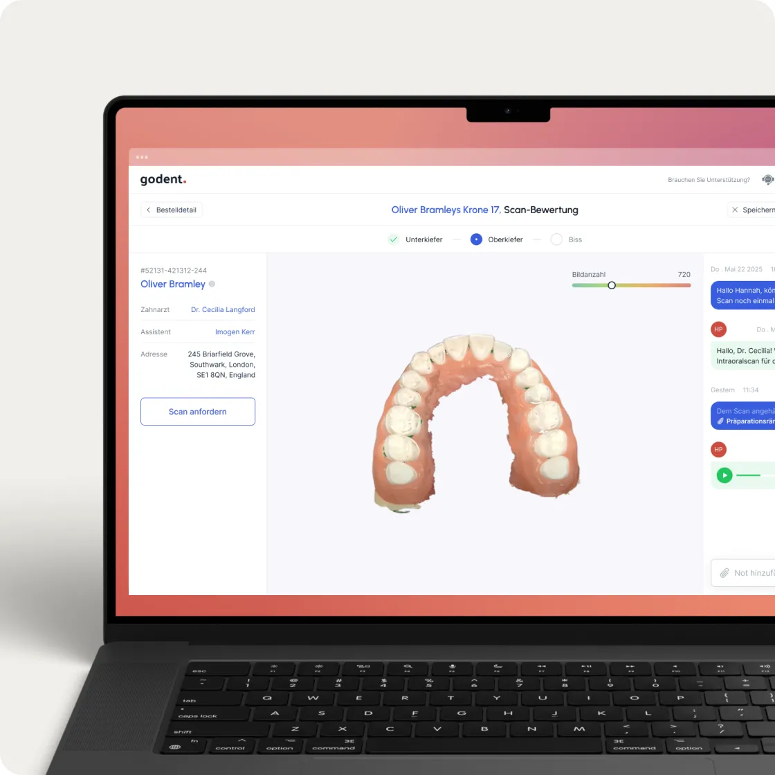 Expert review of dental scan on Godent digital lab portal