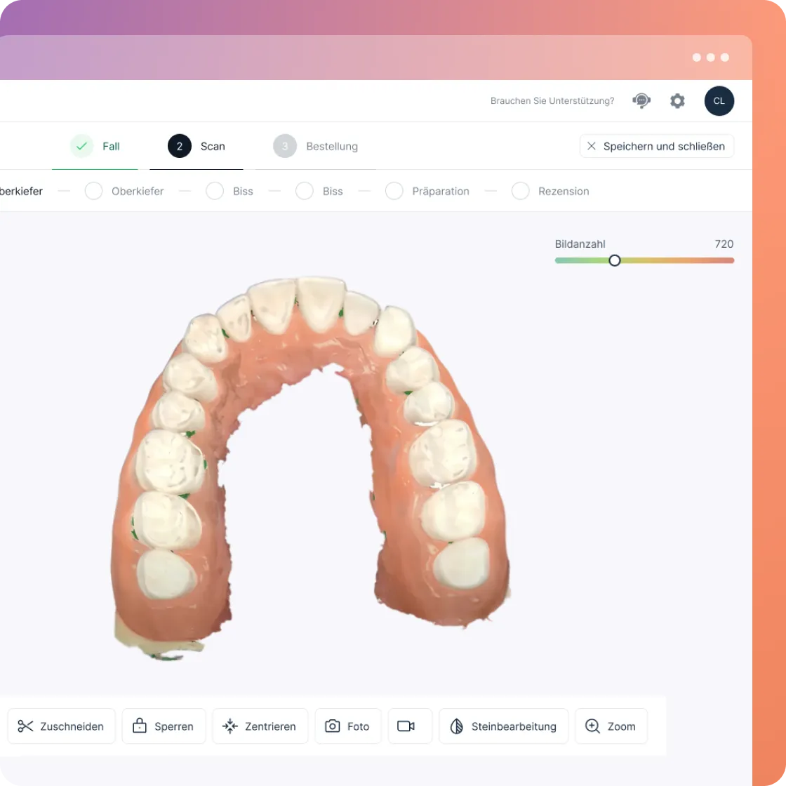 Scan insights dashboard on Godent digital lab portal