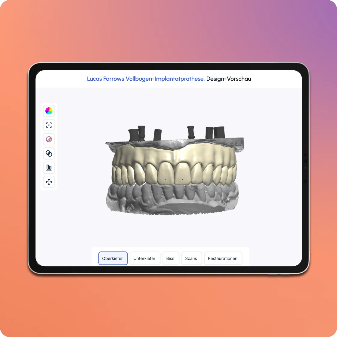 Godent's design preview screen on tablet