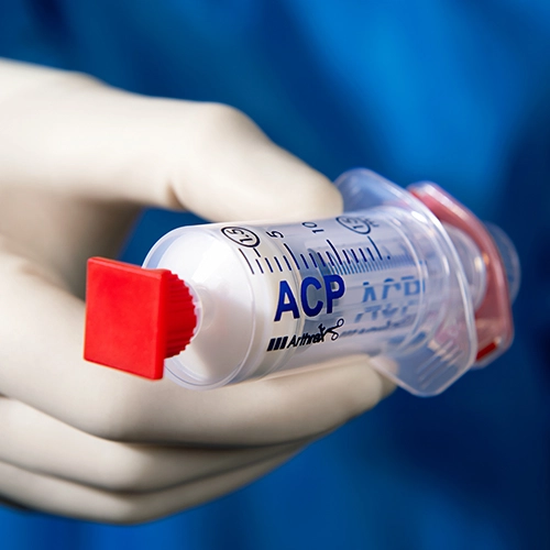Ein Arzt in blauem Kittel und weißen Handschuhen hält eine ACP-Doppelspritze in der Hand.