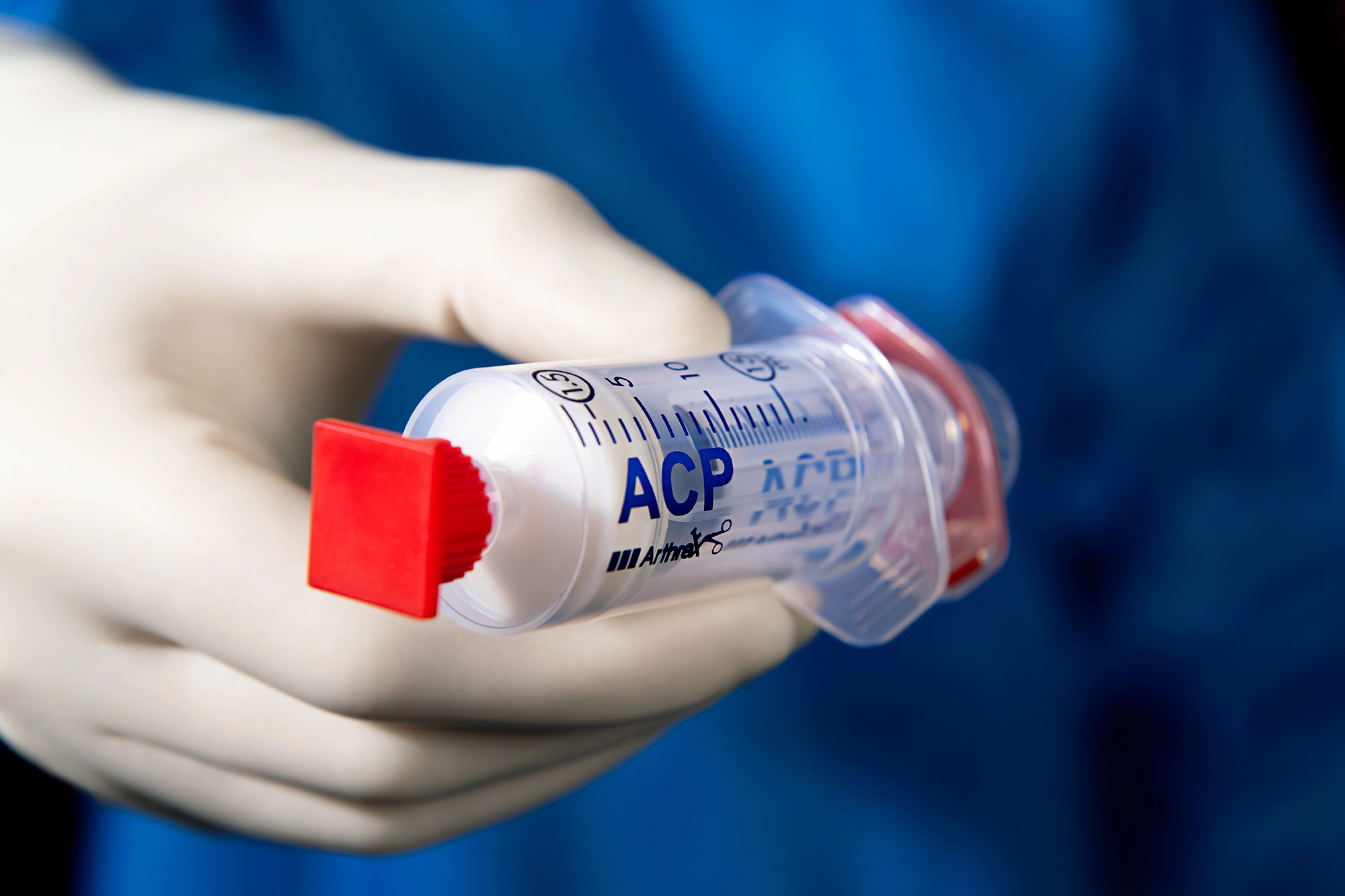 Ein Arzt in blauem Kittel und weißen Handschuhen hält eine ACP-Doppelspritze in der Hand.