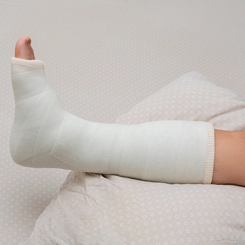 Elevated leg with a bandaged foot following a sports injury.