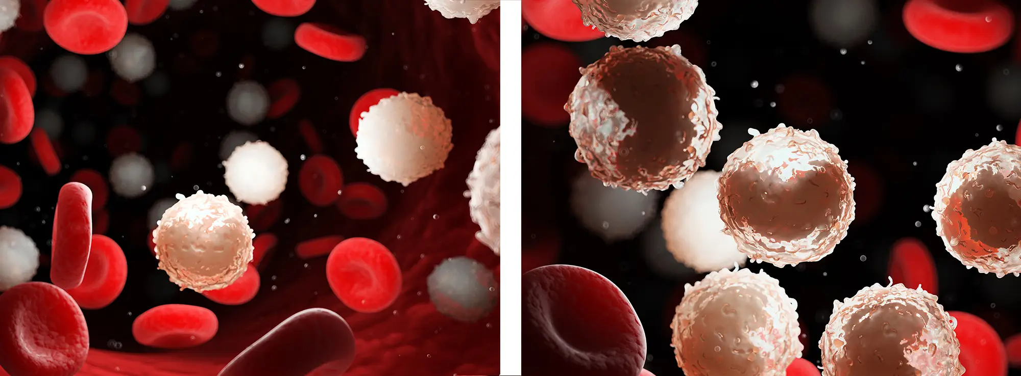 White blood cells comparison – normal count and high count.